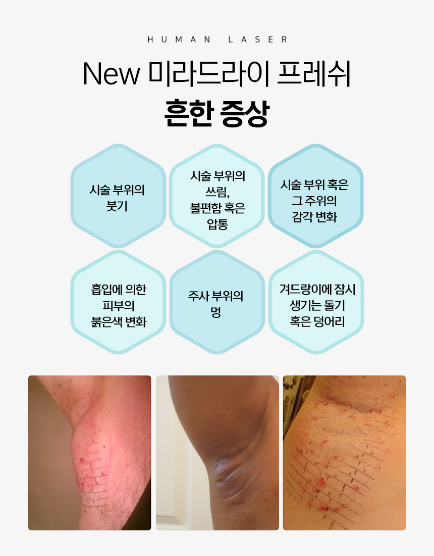 New 미라드라이 프레쉬 흔한 증상